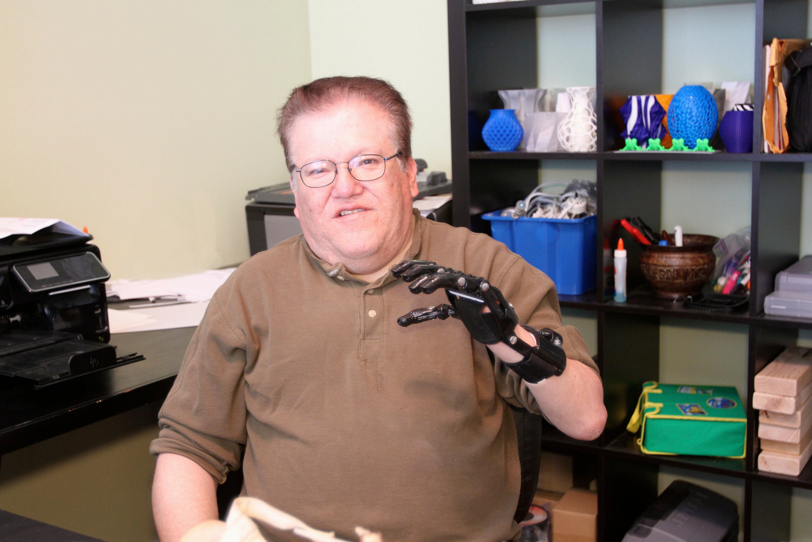 Man Compares His $50 3D Printed Hand to His $42K Prosthesis